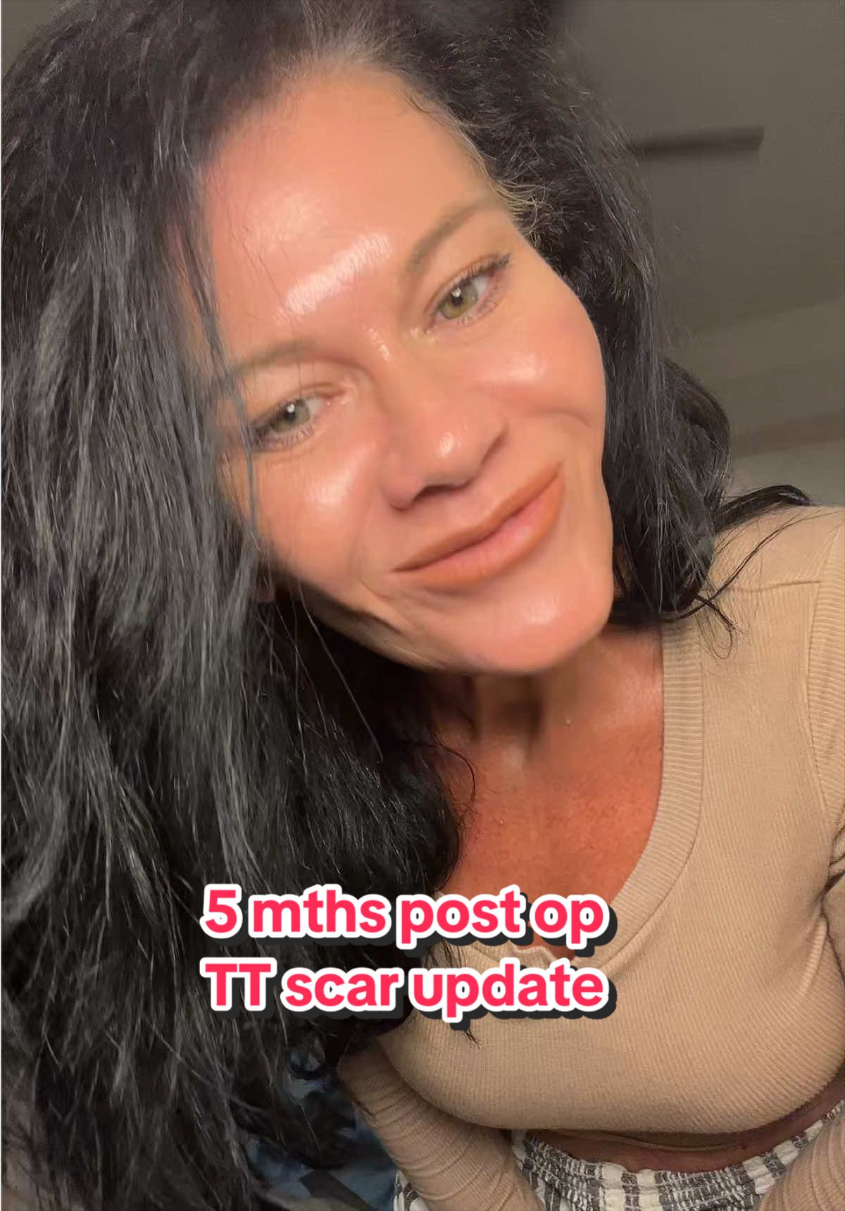 @Kristen D