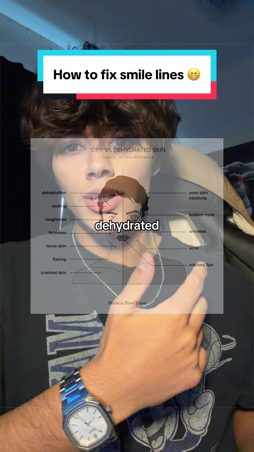 @Cam