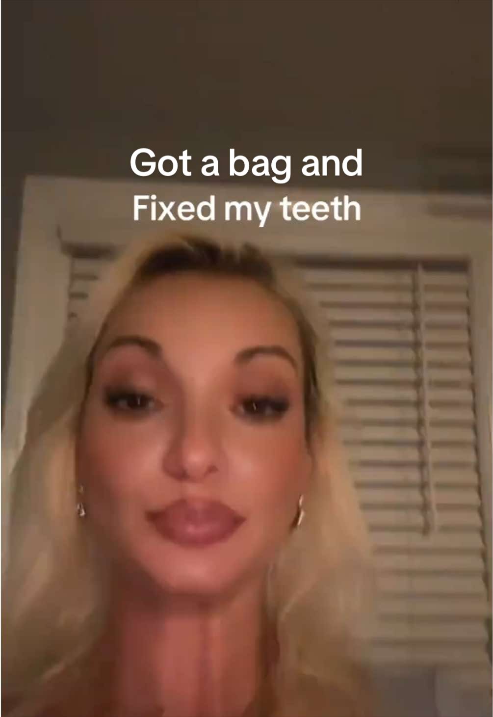 @DentureDiaries
