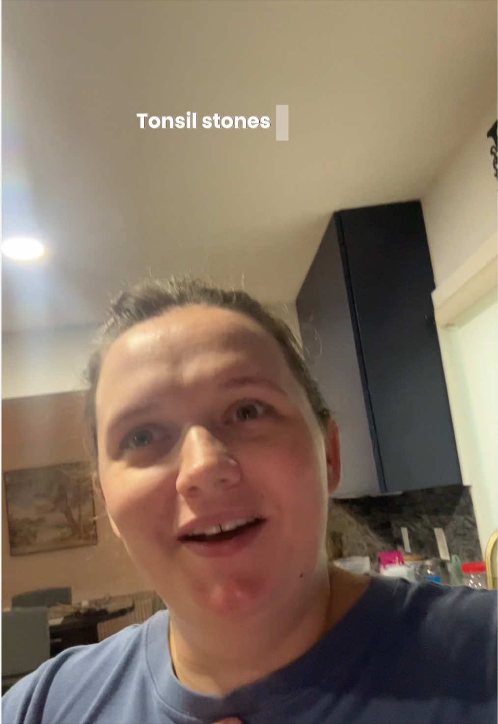 @Jo