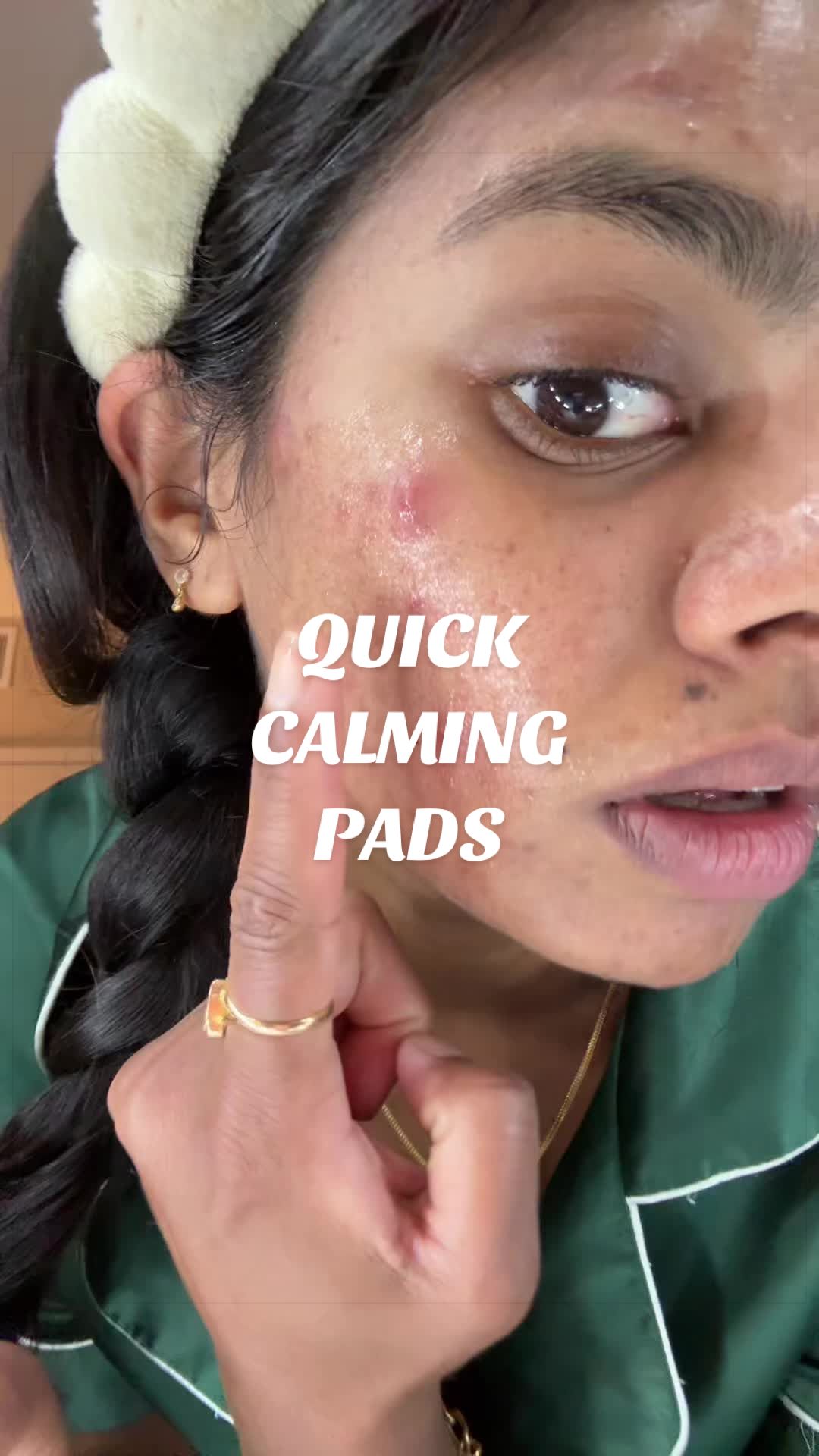 @Nyx Curations | Acne +Wellness