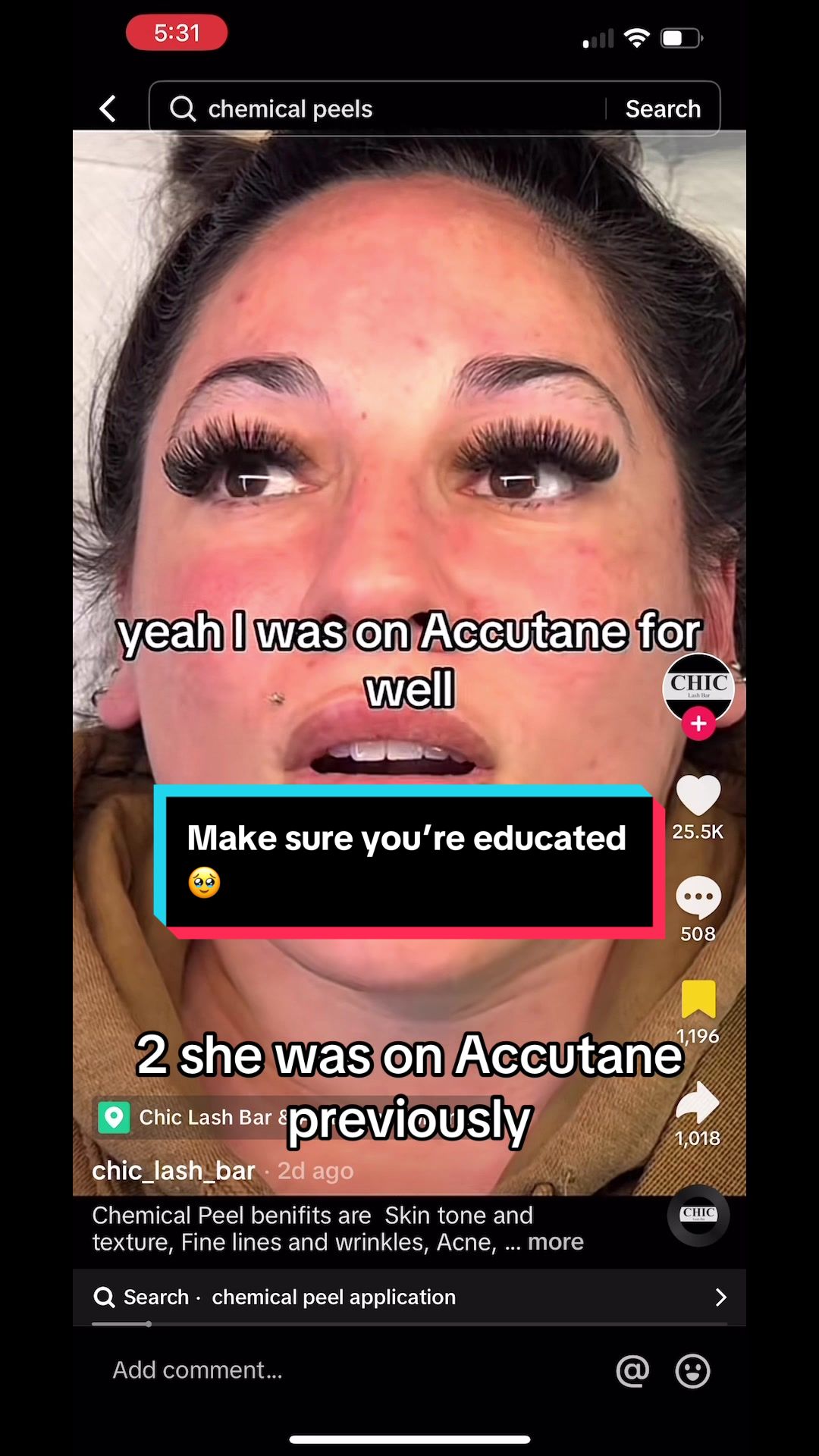 @Alexis Lopez