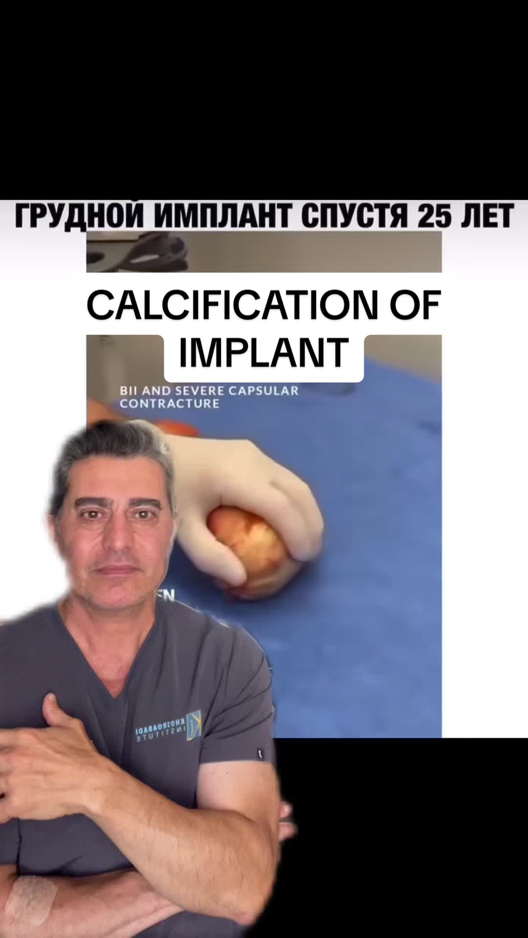 @Alireza Khosroabadi